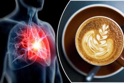 Dairy-free-coffee-822915